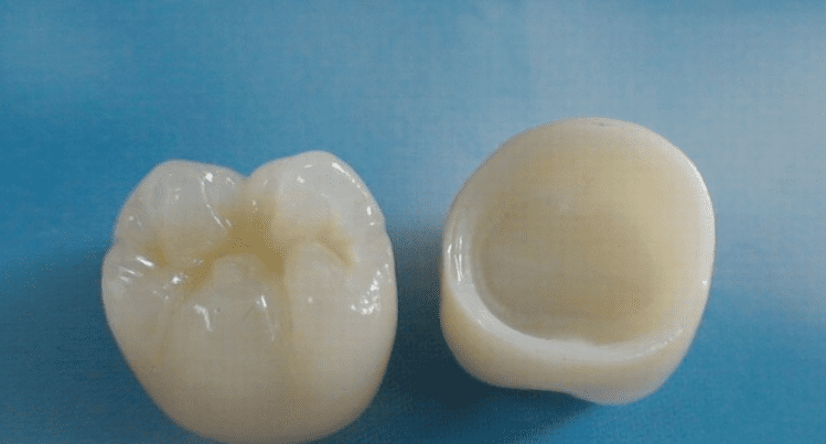Zirconia crowns in Shelby, NC